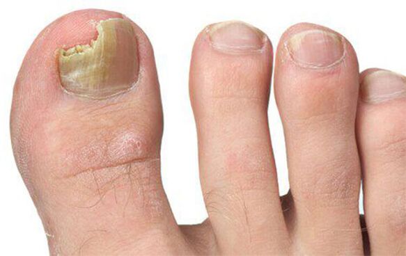 Various forms of fungus