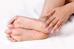treatment of foot skin fungus with cream