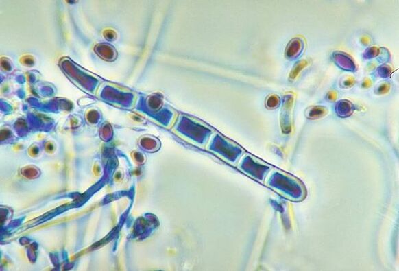 Fungus Trichophyton rubrum under a microscope